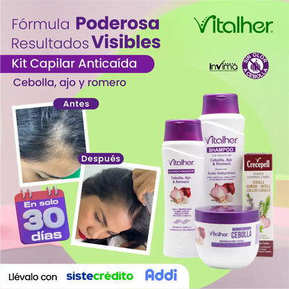 Kit Anticaída cebolla x650 mL con shampoo litro